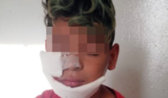 Quilmes: La Policía baleó en la cara a un nene de 10 años frente a un comedor