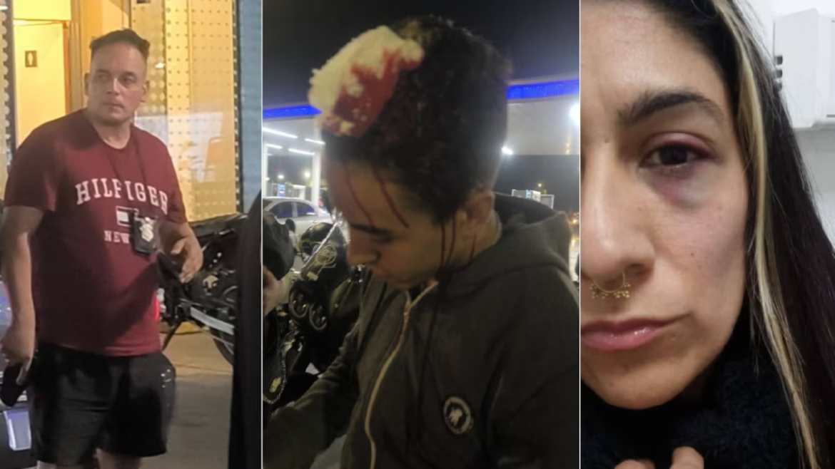 Un hombre agredió a una empleada de una estación de servicio y golpeó a un policía