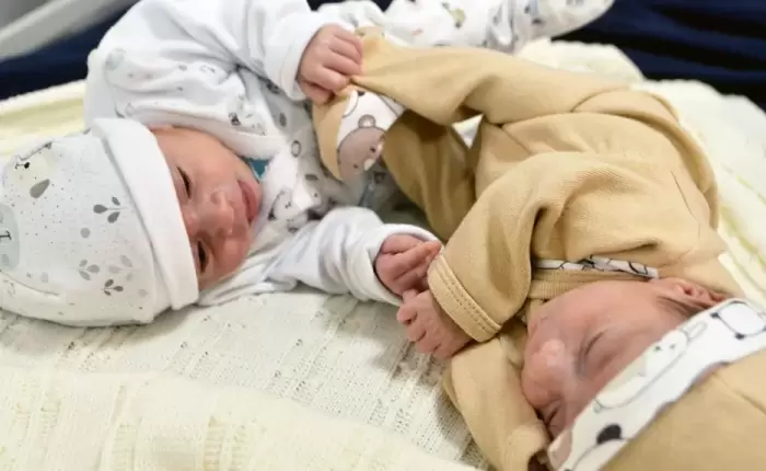 Benicio y Fabricio: los gemelos operados en el útero recibieron el alta médica