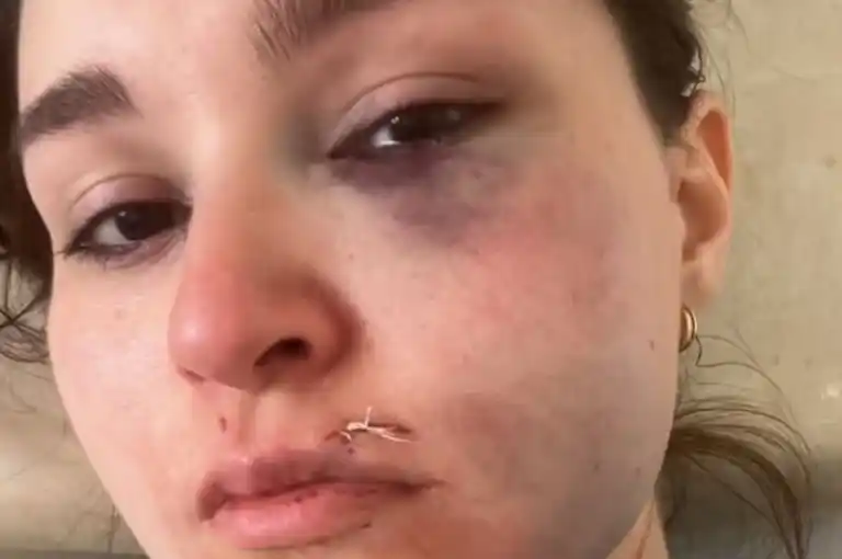 Denuncian un grave hecho de violencia de género en Almirante Brown y buscan al presunto agresor