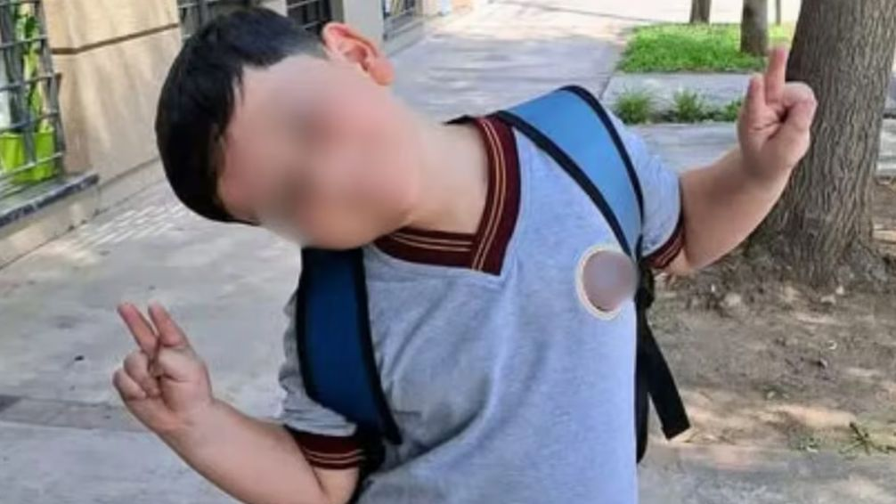 Esperanza por Bastián: evoluciona favorablemente tras una nueva cirugía